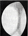 StrcuturePsi